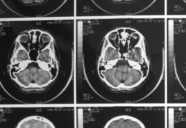 Understanding how the student brain works